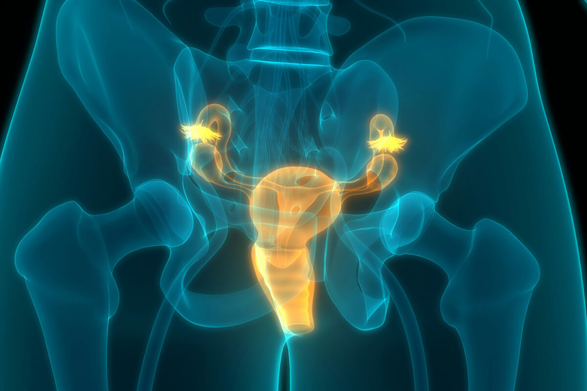 Hypertoner Beckenboden: Was tun bei Verspannungen? - Perifit Hypertoner Beckenboden: Was tun bei Verspannungen? - Perifit